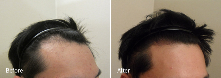 /filedata/md_board/20260102171119_F9D1npia_afterEBAAA8EBB09CEC9DB4EC8B9D_4.jpg 전후사진