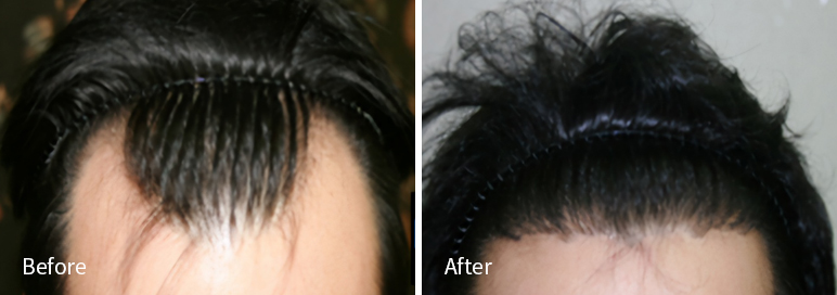 /filedata/md_board/20260102171139_QLH75CAO_afterEBAAA8EBB09CEC9DB4EC8B9D_5.jpg 전후사진