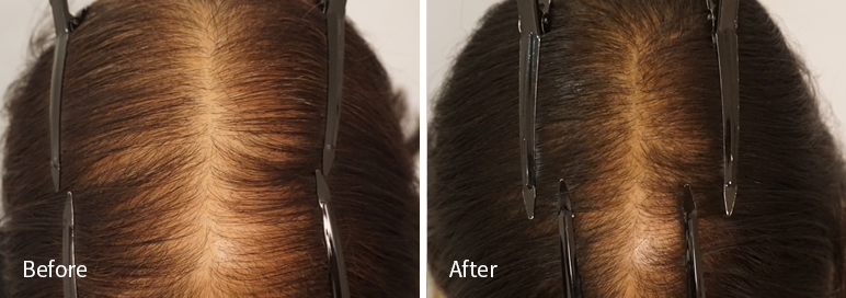 /filedata/md_board/20260102171217_L6T5gDcd_afterEBAAA8EBB09CEC9DB4EC8B9D_7.jpg 전후사진