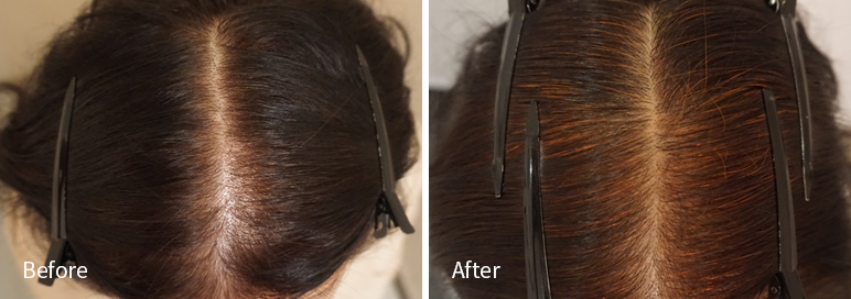 /filedata/md_board/20260102171350_GuNQHY8Z_afterEBAAA8EBB09CEC9DB4EC8B9D_11.jpg 전후사진