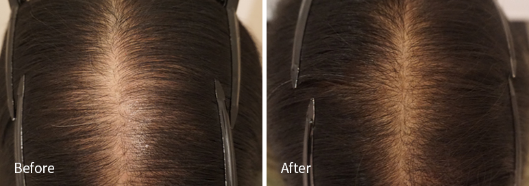 /filedata/md_board/20260102171419_RtF3pKT8_afterEBAAA8EBB09CEC9DB4EC8B9D_12.jpg 전후사진