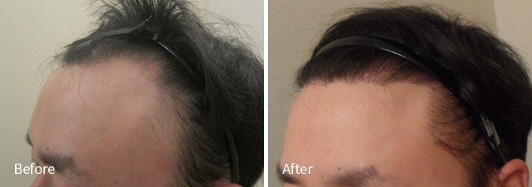 /filedata/md_board/20260102171725_jEMmh1fX_afterEBAAA8EBB09CEC9DB4EC8B9D_19.jpg 전후사진