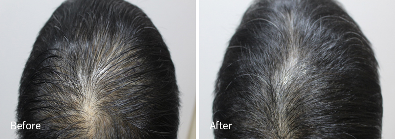 /filedata/md_board/20260102181838_8lvTVJgo_afterEB9190ED94BCEBACB8EC8BA0_1.jpg 전후사진