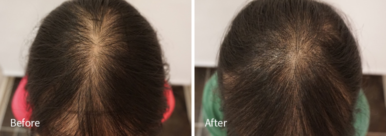 /filedata/md_board/20260102181856_bhl5JrGv_afterEB9190ED94BCEBACB8EC8BA0_2.jpg 전후사진