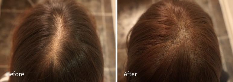 /filedata/md_board/20260102181931_icnOjdJA_afterEB9190ED94BCEBACB8EC8BA0_3.jpg 전후사진