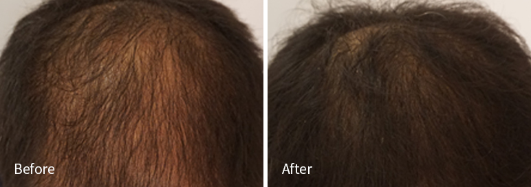 /filedata/md_board/20260102181951_r6YNuZ51_afterEB9190ED94BCEBACB8EC8BA0_5.jpg 전후사진