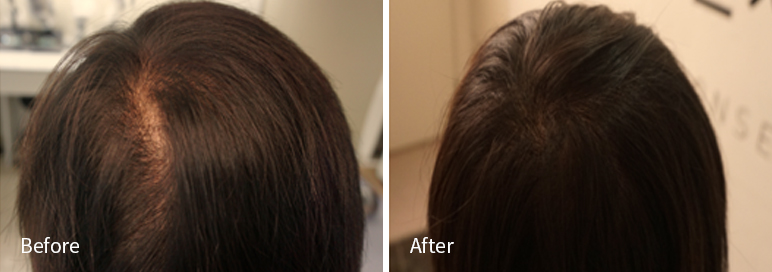 /filedata/md_board/20260102182006_o8hZMtpI_afterEB9190ED94BCEBACB8EC8BA0_6.jpg 전후사진