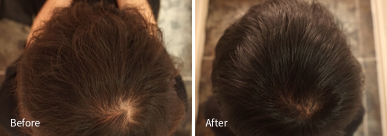 /filedata/md_board/20260102182025_m2h1So3H_afterEB9190ED94BCEBACB8EC8BA0_7.jpg 전후사진