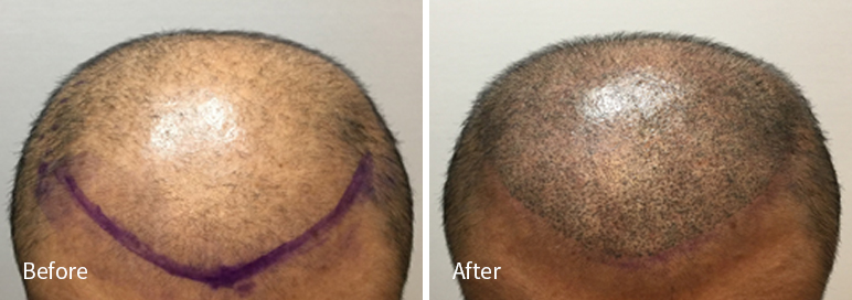 /filedata/md_board/20260102182129_87Xd09pC_afterEB9190ED94BCEBACB8EC8BA0_9.jpg 전후사진