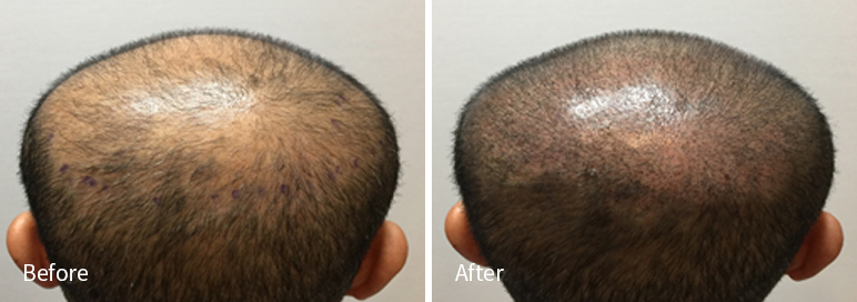 /filedata/md_board/20260102182142_ZgvfNelH_afterEB9190ED94BCEBACB8EC8BA0_10.jpg 전후사진