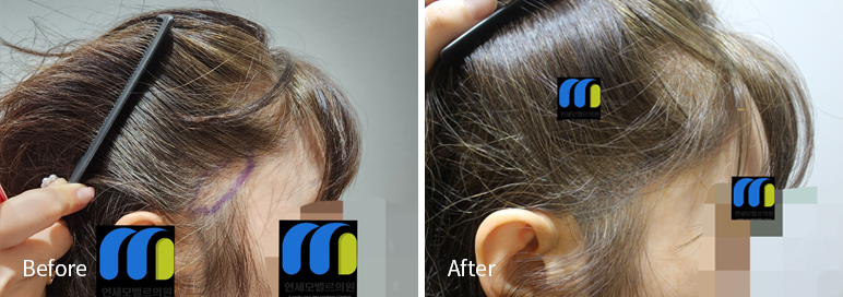 /filedata/md_board/20260102182439_7wQKq9yS_afterEB9190ED94BCEBACB8EC8BA0_22.jpg 전후사진