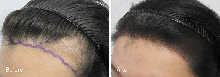 /filedata/md_board/20260102182944_EWiZsFM5_afterED97A4EC96B4EB9DBCEC9DB8_5.jpg 전후사진