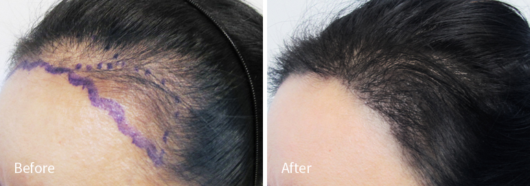 /filedata/md_board/20260102183101_QdCKgtz7_afterED97A4EC96B4EB9DBCEC9DB8_10.jpg 전후사진