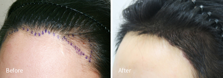 /filedata/md_board/20260102183114_UJdByoNW_afterED97A4EC96B4EB9DBCEC9DB8_11.jpg 전후사진