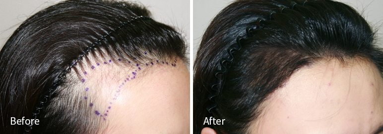 /filedata/md_board/20260102183131_1oWHkV5S_afterED97A4EC96B4EB9DBCEC9DB8_12.jpg 전후사진