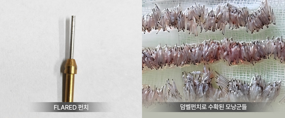 모낭1